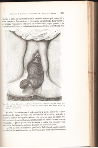 Trattato completo di Ginecologia
