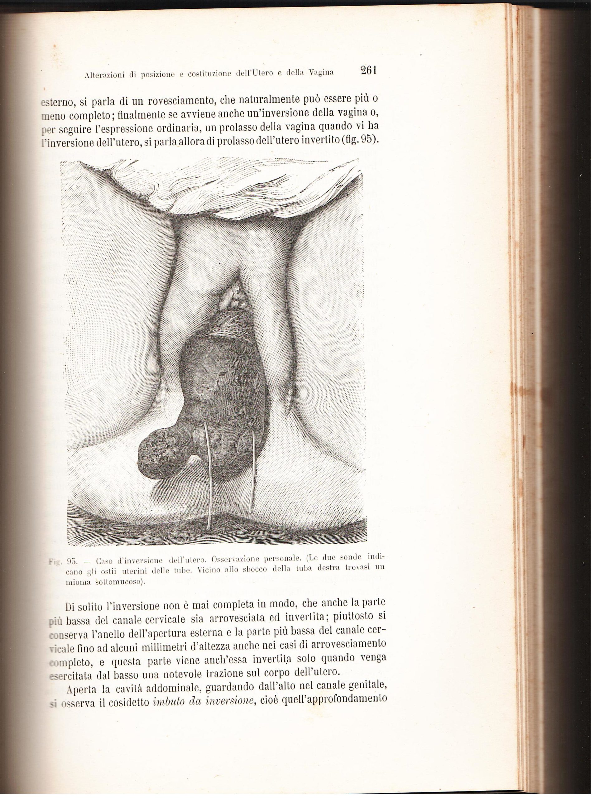 Trattato completo di Ginecologia